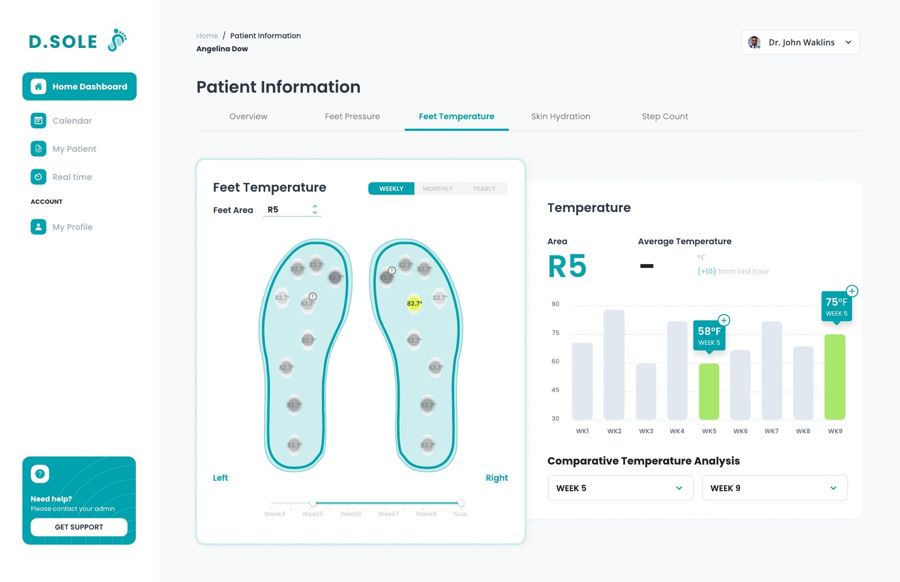 Foot temperature detail view: a foot map with sensor areas, and a weekly bar chart for area R5 comparing week 5 and week 9